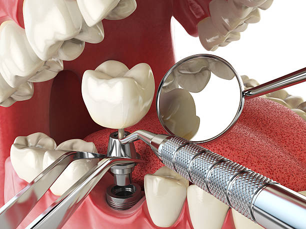 Best Emergency Treatment for Jaw Pain or Injury in Poynette, WI
