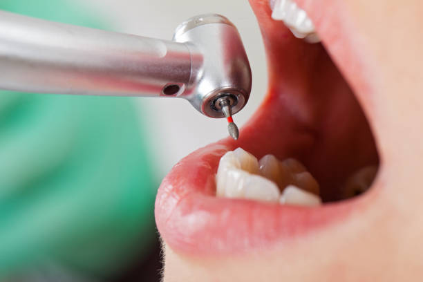 Best Emergency Treatment for Oral Infections in Poynette, WI